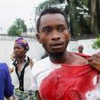 An injured Congolese opposition supporter walks outside the headquarters of the Union for Democracy and Social Progress (UDPS) during violent protests to press President Joseph Kabila to step down, in the Democratic Republic of Congo's capital Kinshasa...