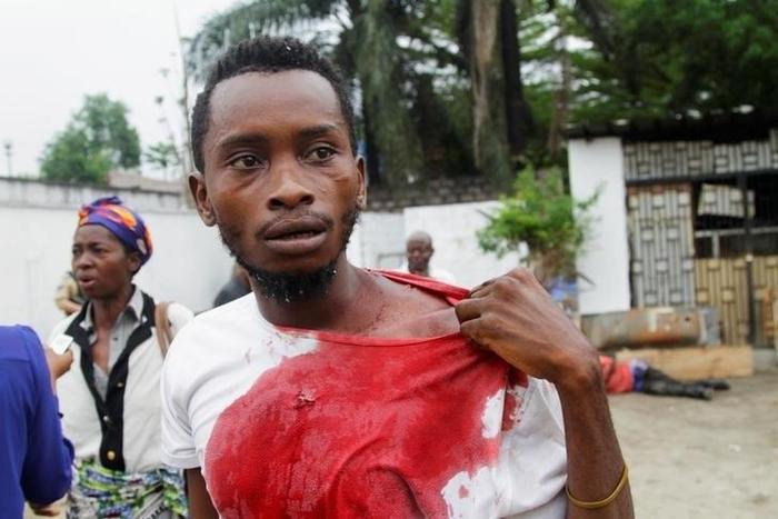 An injured Congolese opposition supporter walks outside the headquarters of the Union for Democracy and Social Progress (UDPS) during violent protests to press President Joseph Kabila to step down, in the Democratic Republic of Congo's capital Kinshasa...
