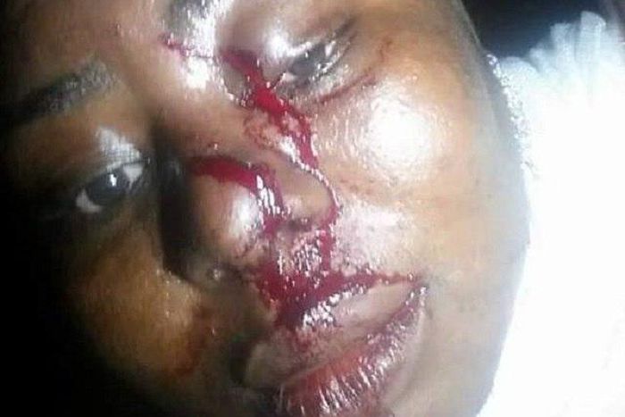 The battered Mrs. Alabi