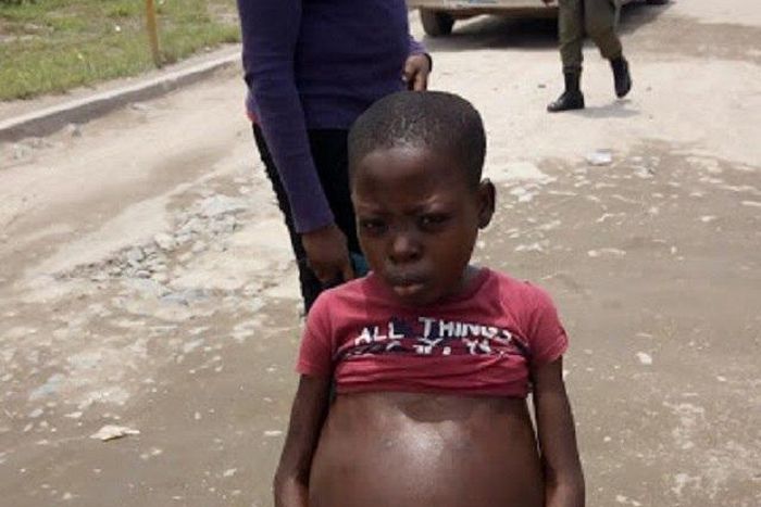 The abused sick girl and the fraudster