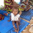 An infant suffering from malnutrition and malaria sits with others as they wait for treatment at an international NGO MSF (Doctors Without Boarders) outpost in Guidan-Roumdji 