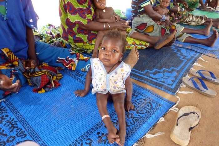 An infant suffering from malnutrition and malaria sits with others as they wait for treatment at an international NGO MSF (Doctors Without Boarders) outpost in Guidan-Roumdji 