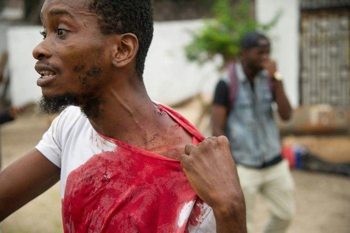 A man shows his injuries on September 20, 2016 near the offices of the main opposition Union for Democracy and Social Progress party which were torched overnight in Kinshasa