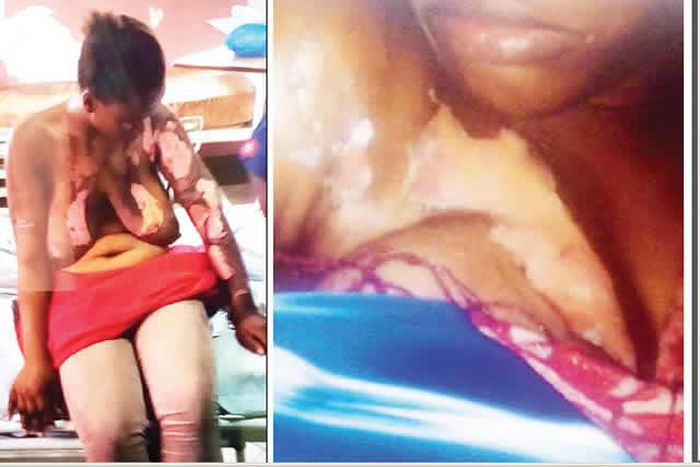 The two fighters, Biliki and Muyibat on their hospital beds