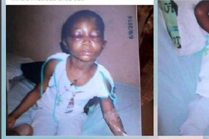 The little victim, Precious Nwole