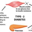 Diabetes type 2