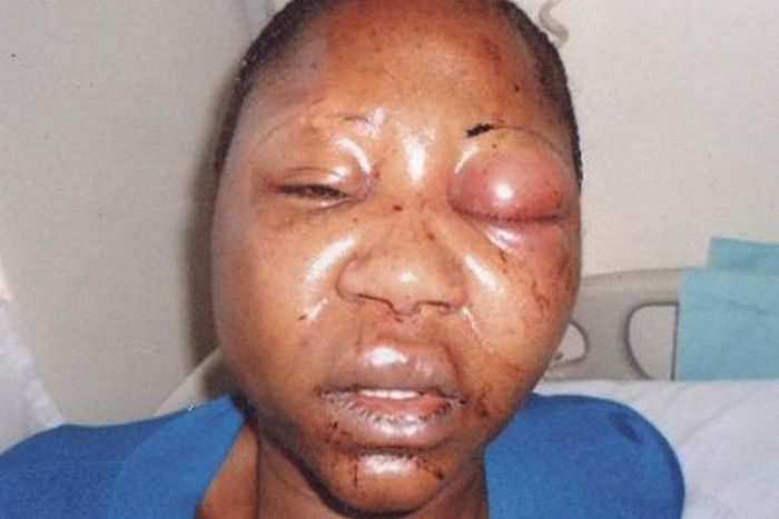 FIDA urges men to stop domestic violence