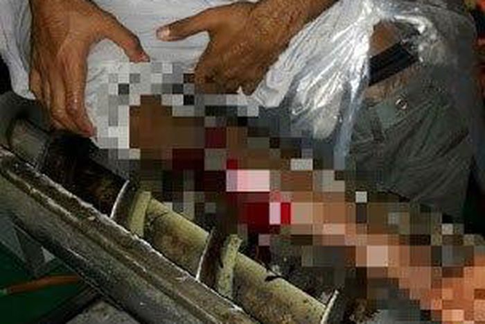 Factory worker's hand gets trapped in spice mixing machine