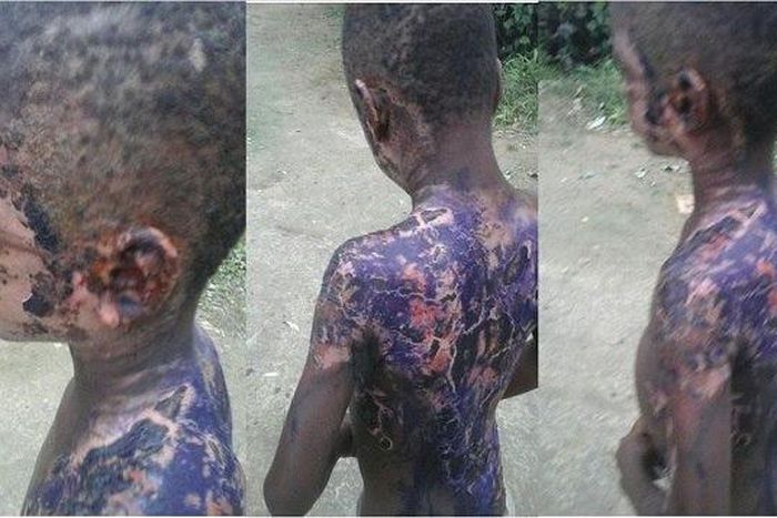 The injured Daniel Edet