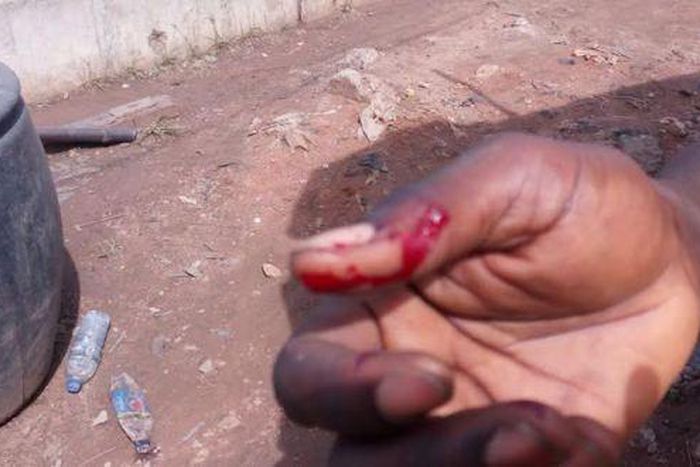 The traffic offender bit the FRSC officer