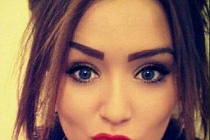 See pictures of 17-yr old girl who BLEEDS from her EYES, EARS and MOUTH