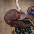 Malnourished children in Nigeria's IDP camps 