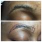 Microblading