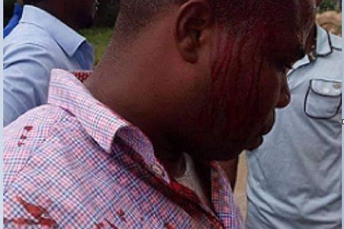 The bloodied Alex, a victim of police brutality