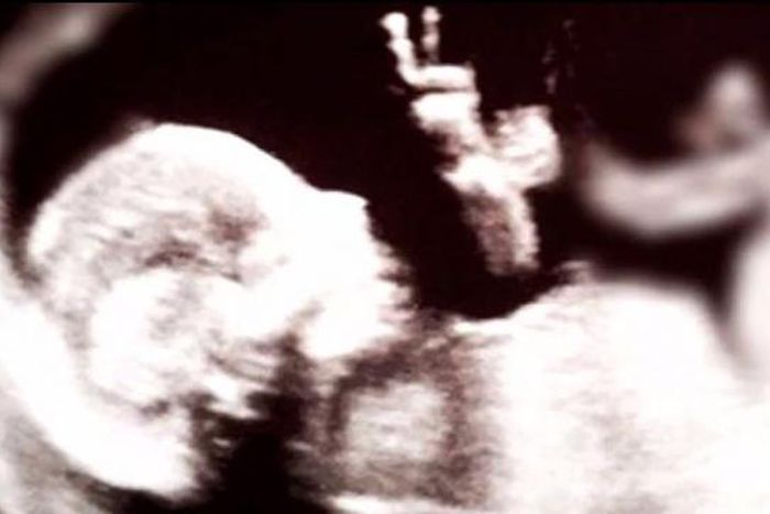 Baby in the womb gives peace sign in ultrasound photo