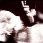 Baby in the womb gives peace sign in ultrasound photo