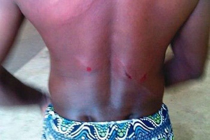 The injured IBEDC manager, Salau Adekunle