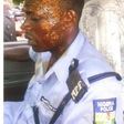 The assaulted police Corporal, Kayode Akingbade