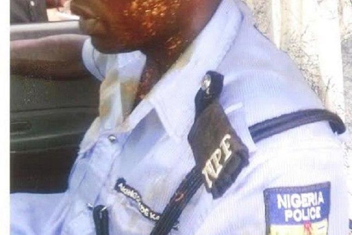 The assaulted police Corporal, Kayode Akingbade