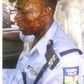 The assaulted police Corporal, Kayode Akingbade
