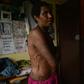 Mother-of-two Rachel shows the scars from wounds inflicted on her in April 2017 when she was accused of sorcery and tortured with hot machetes, spades and rods for a full day by people she knew in the Tsak Valley in the Highlands of Papua New Guinea
