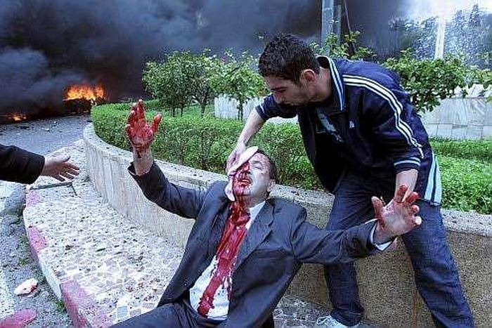 Yemen university bomb kills gardener, injures two students