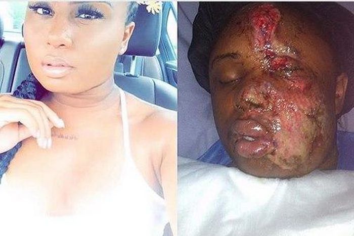 Mera in before and after photo