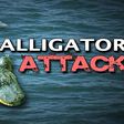 Alligator attacks 2-year old in Florida