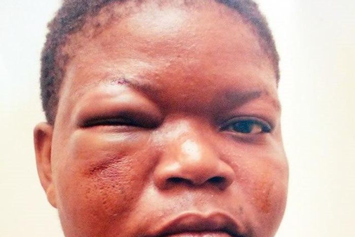 The battered Dupe Balogun