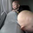Tanzania criticises film documenting attacks on albinos for witchcraft