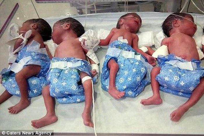 Woman gives birth to 5 children after thinking she was pregnant with one baby