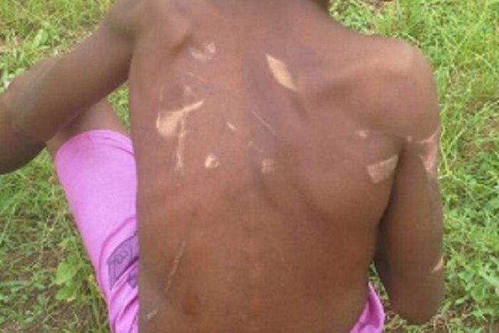 The abused boy, Victor Uso