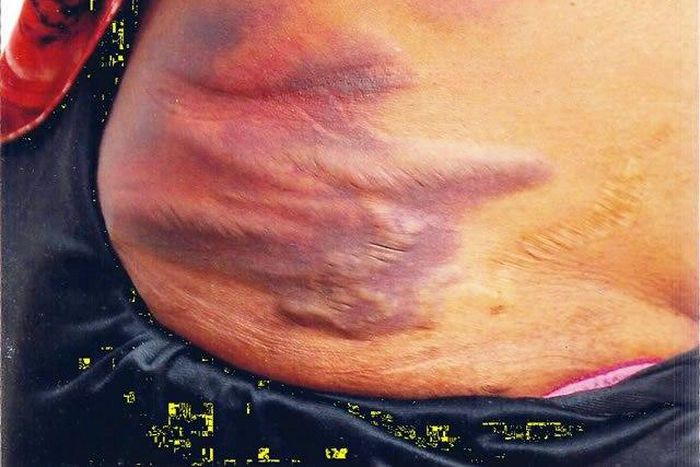 The assaulted Bukola Olasunkanmi