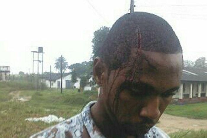 The injured Humphrey Duru