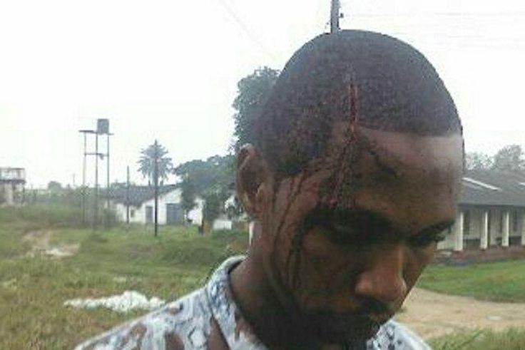 The injured Humphrey Duru