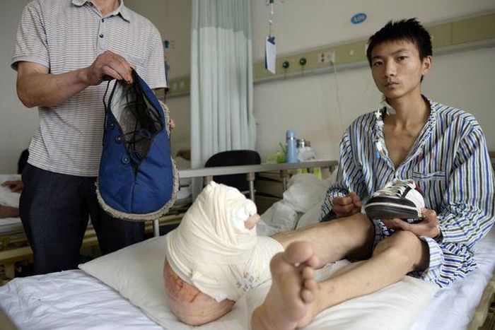 Shocking pictures of Man with unusually large foot would put you to tears