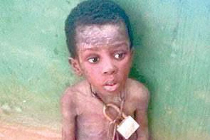 Malnourished boy, rescued by the authorities
