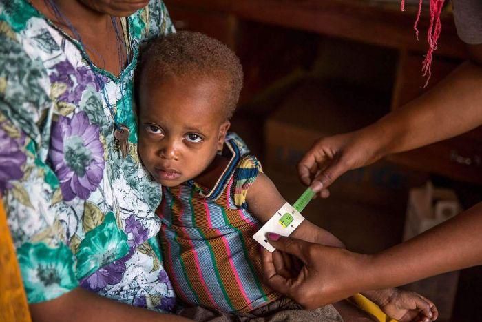 UNICEF finds dramatic inequality among world's poorest, richest children