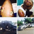 Nosa Rex involved in ghastly car accident