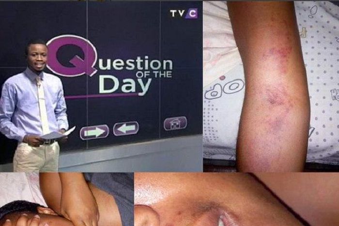 ___5054741___https:______static.pulse.com.gh___webservice___escenic___binary___5054741___2016___5___19___17___Battered-Girlfriend