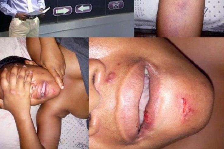 ___5054741___https:______static.pulse.com.gh___webservice___escenic___binary___5054741___2016___5___19___17___Battered-Girlfriend