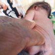 Baby born without anus in Yobe