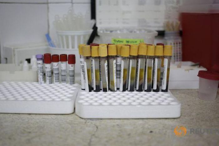 Brazil confirms Zika infection from a blood transfusion