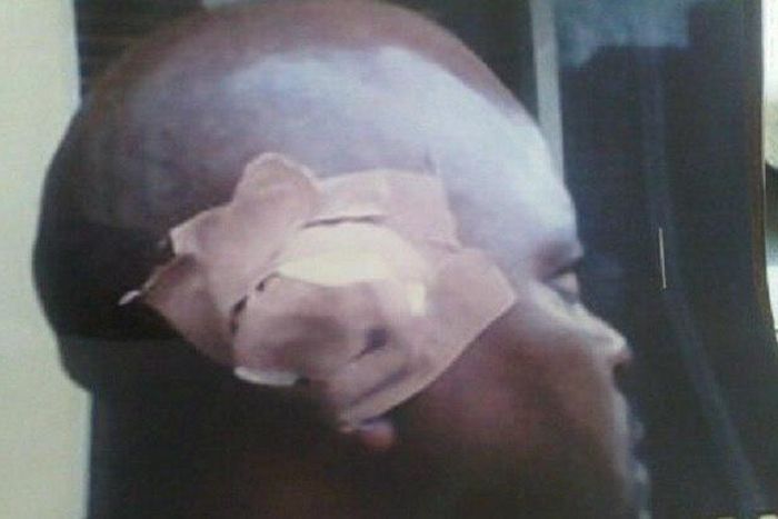 Chigozie Chukwu and his cut ear