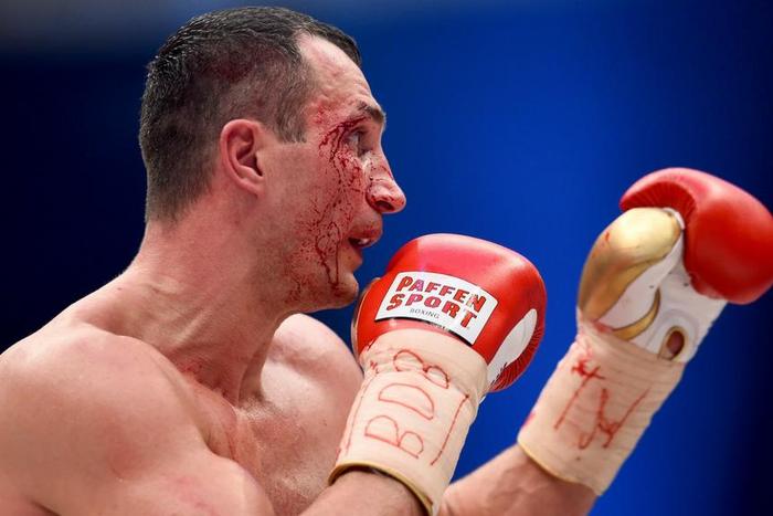 ___4730870___https:______static.pulse.com.gh___webservice___escenic___binary___4730870___2016___2___26___11___wladimirklitschko-cropped_9i9qhkzonho81bvk67vqyx04c