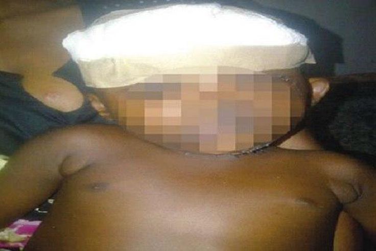 This little girl was lucky to be alive