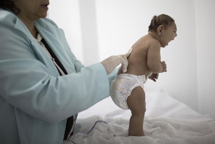 Brazil reports increase in microcephaly cases linked to Zika