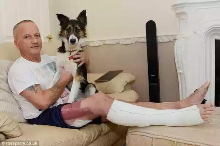 Ian Stewart suffers burns from colourful rock that turned out to be phosphorus