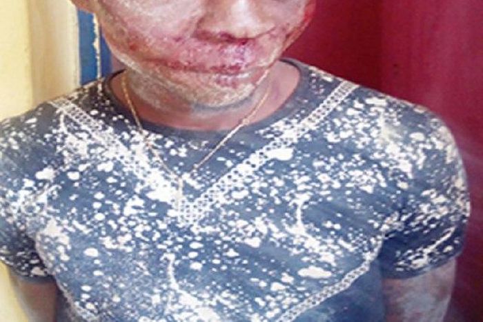 The armed robbery suspect, Stanley