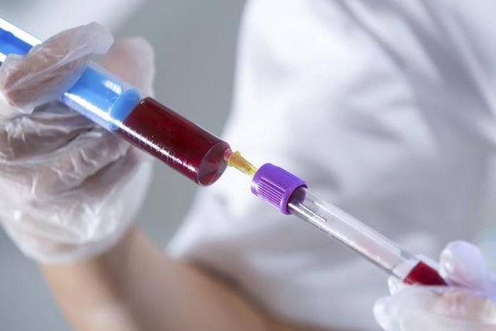 Excess acid in body causes shock, death - Physician warns